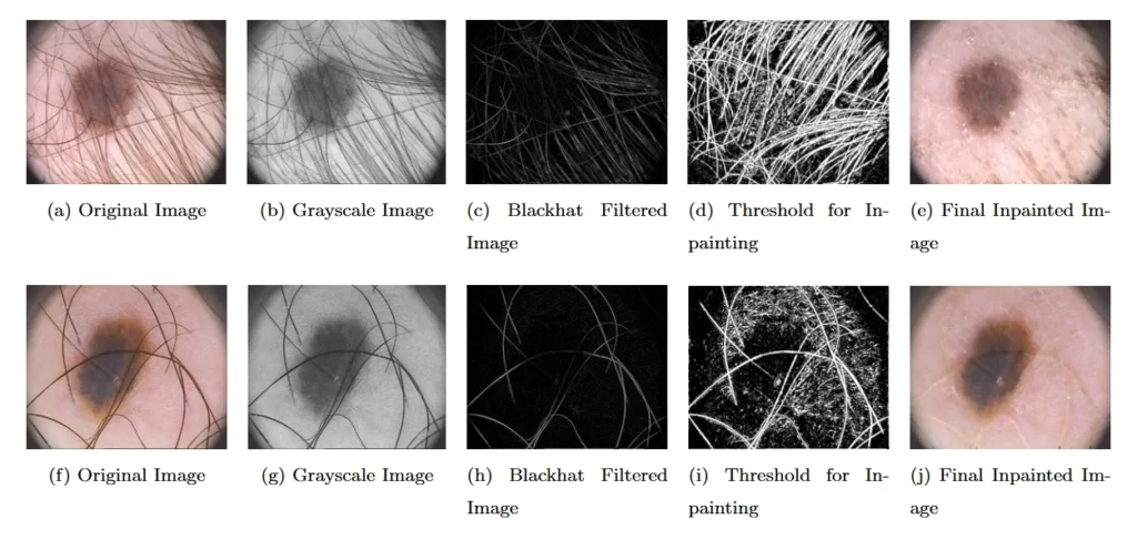 قطعهبندی تصاویر پزشکی (Medical Image Segmentation)