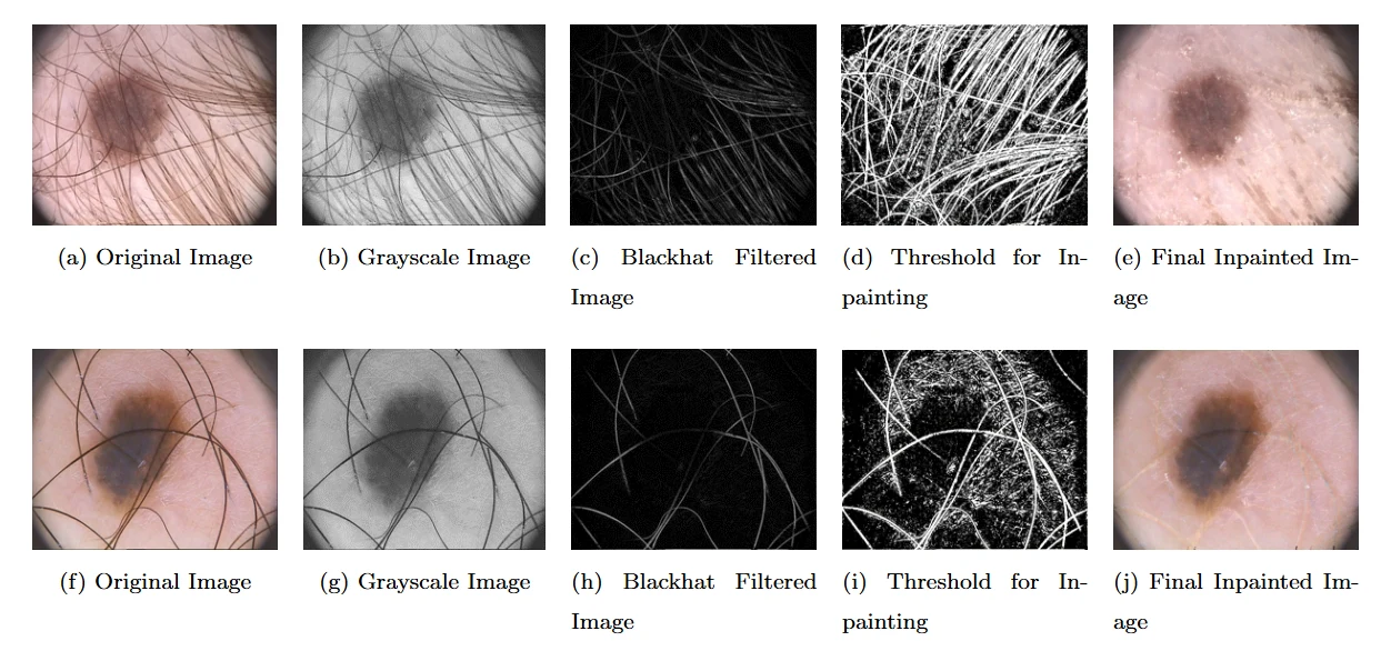 قطعه‌بندی تصاویر پزشکی (Medical Image Segmentation) 